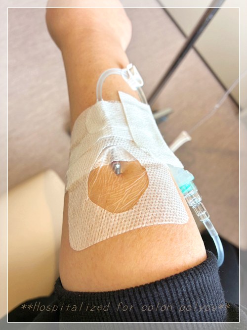 大腸ポリープ切除のために入院中の点滴